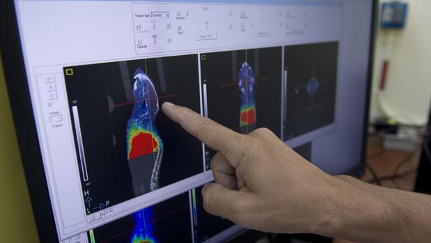Un médico observa la evolución de un tumor