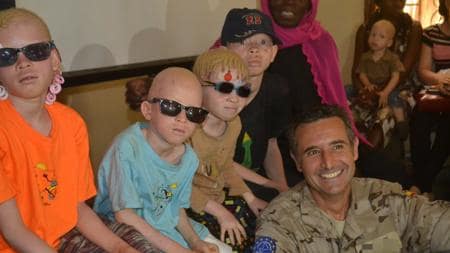 Españoles en Mali dan a niños albinos gafas y protector solar de Cofares y Cortefiel
