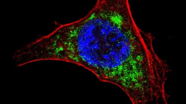 Imagen del virus de la hepatitis C (Pablo Gastaminza y Francis V. Chisari) y célula infectada con la vacuna MVA-HCV produciendo las proteínas del virus de la hepatitis C, en verde.