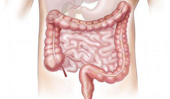 Microbiota intestinal
