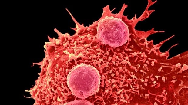 La hemofilia A es un grave trastorno genético