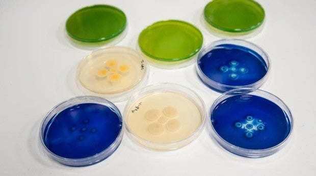 Muestras de la bacteria resistente «S. aureus», una de las más temidas en los hospitales